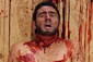 Anatomy Titus Fall of Rome